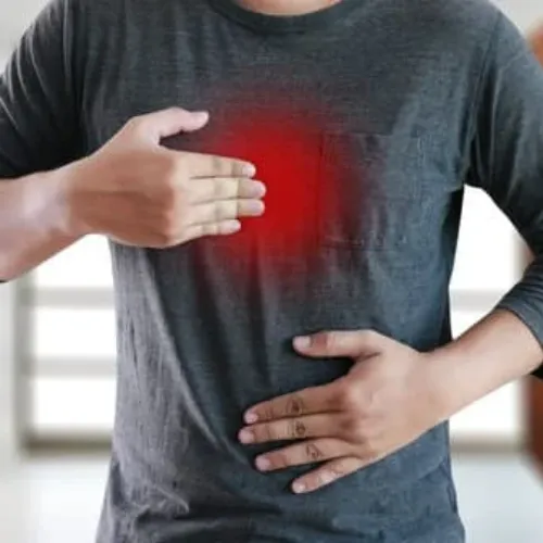 Acidity Ayurvedic treatment