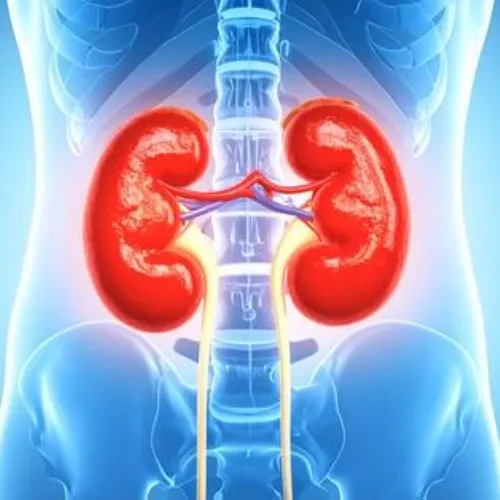 Kidney Stones ayurvedic treatment